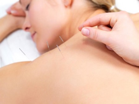 BodyDevotion Acupuncture and Massage
